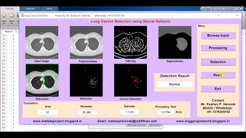 Lung Cancer Detection using Neural Network