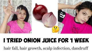 I applied onion juice on my hair for 7 days | hair fall, hair growth, scalp infection, dandruff