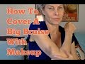How To Cover A Bruise