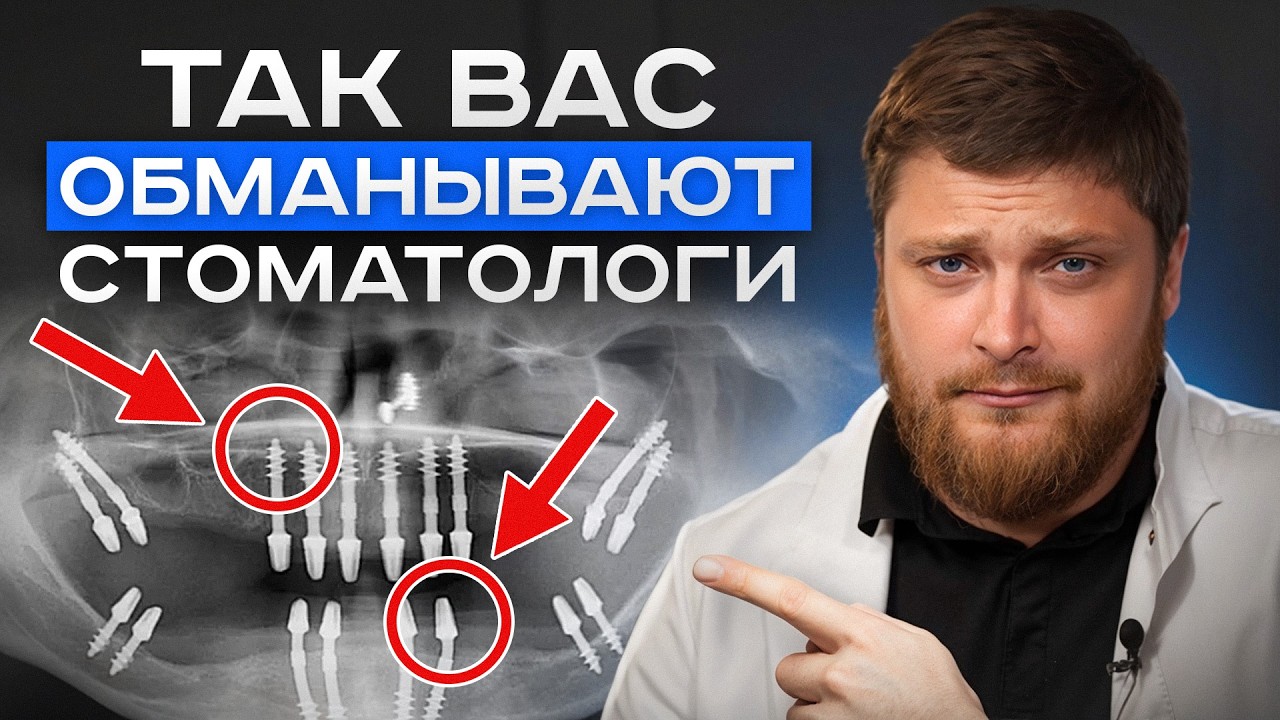 СРОЧНО смотрите, если не хотите потерять все зубы! Что такое базальная имплантация?
