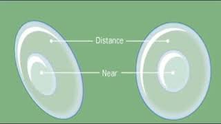 How Do Bifocal Soft Contact Lenses Work? screenshot 1