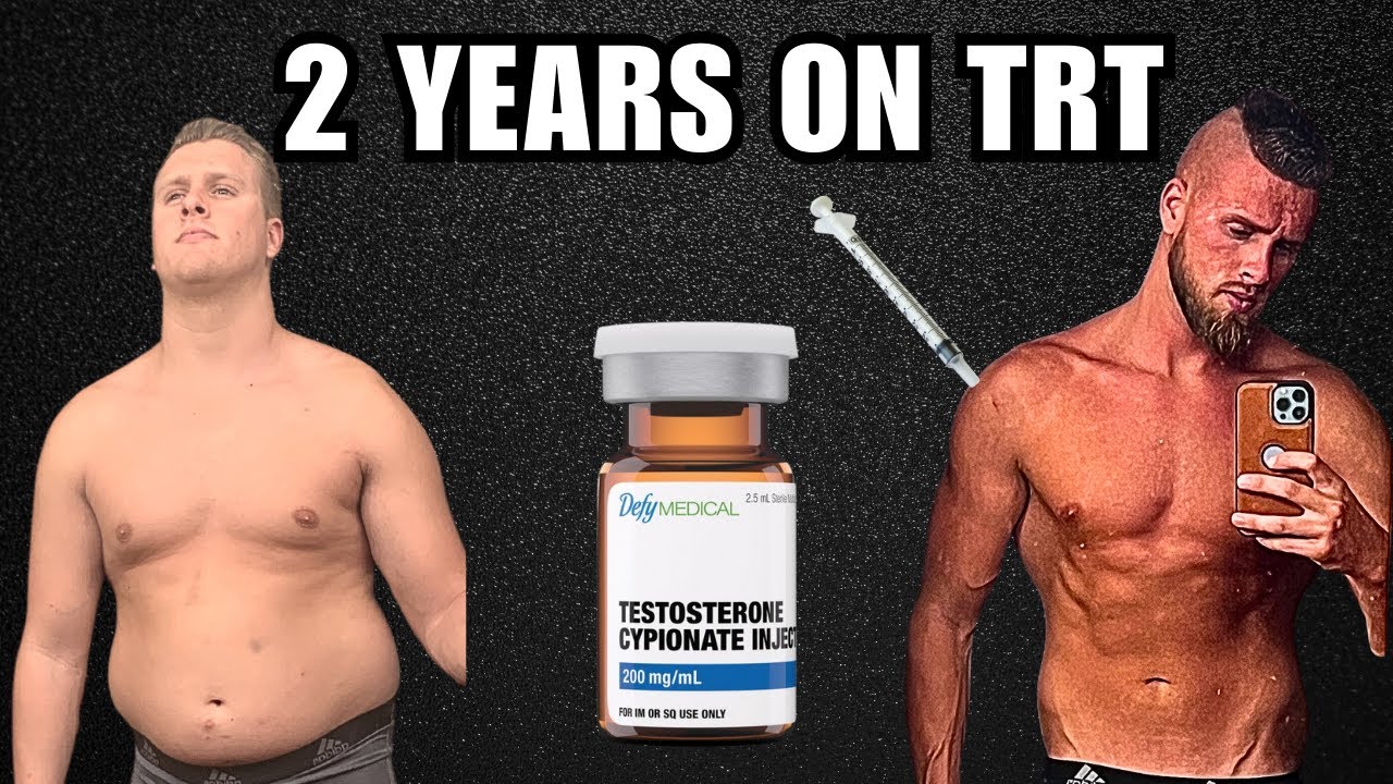 2 YEARS ON TRT - Testosterone Replacement Therapy (Energy? Anxiety? ED ...