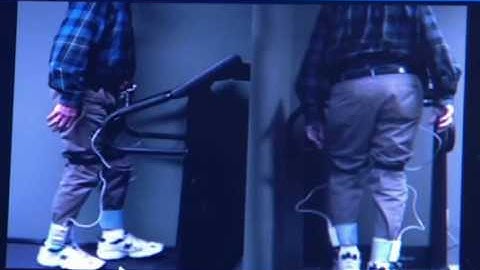 How One Podiatrist Uses the F-Scan In-Shoe System: Part 1