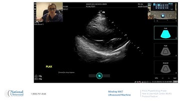 How to Use iWorks Protocol Feature on the Mindray MX7 Ultrasound Machine