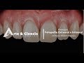 ►Fotografía Extraoral e Intraoral | Dr. Byron Miranda Salguero