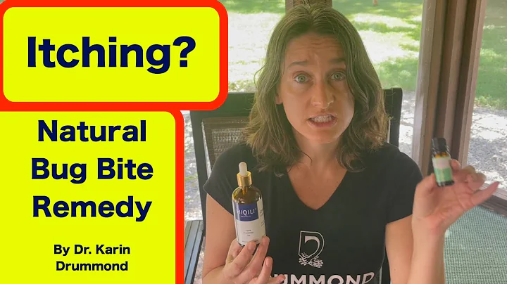 Natural itch remedy for bug bites and what to do about a tick bite