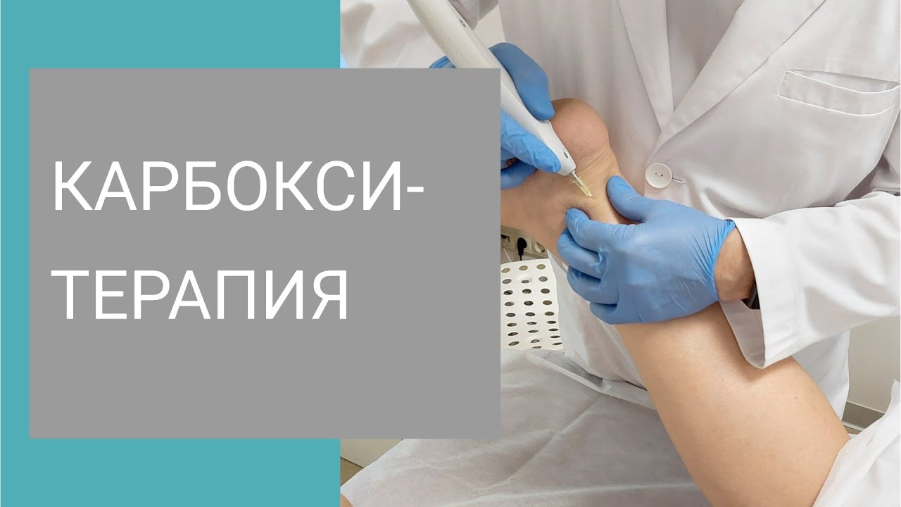 Карбокситерапия – уколы углекислым газом