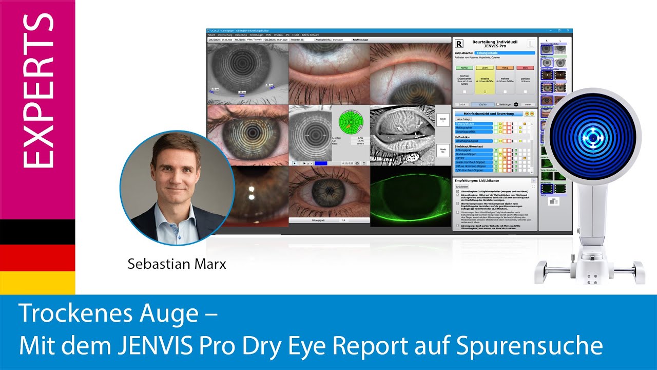 Jenvis Report.pdf Trockenes Auge – Mit dem JENVIS Pro Dry Eye Report auf Spurensuche ...