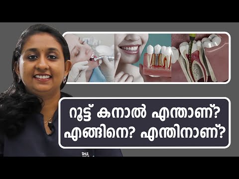 റൂട്ട് കനാൽ എന്താണ്? എങ്ങിനെ? എന്തിനാണ് ? Root Canal Treatment what? how? why? | Dr. Anisha P John