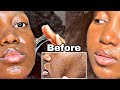 One Week of FLAXSEED GEL on My Face Cleared my TEXTURED Skin & Dark Spots *SHOCKING RESULTS*