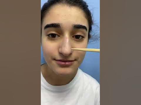 Пластика носа 👃 - YouTube