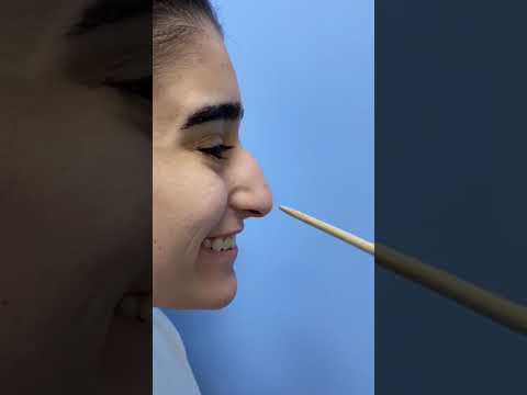 Видео: Как сделать нос менее выпуклым?