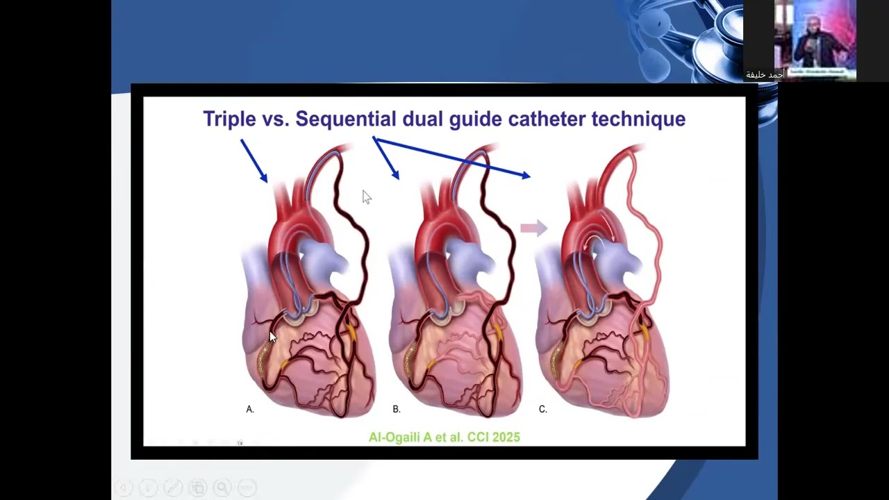 4 Retrograde approach through graft