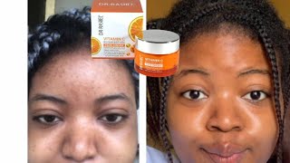 My honest review after using Dr rashel face cream. Does it really work?