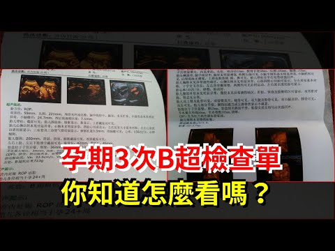 孕期3次B超檢查單，你知道怎麼看嗎？