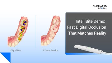 IntelliBite Demo:Fast Digital Occlusion That Matches Reality