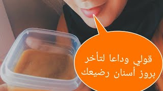 تسريع بروز أسنان الرضيع | وصفة سحرية + نصائح لتغذية الرضيع خلال مرحلة التسنين