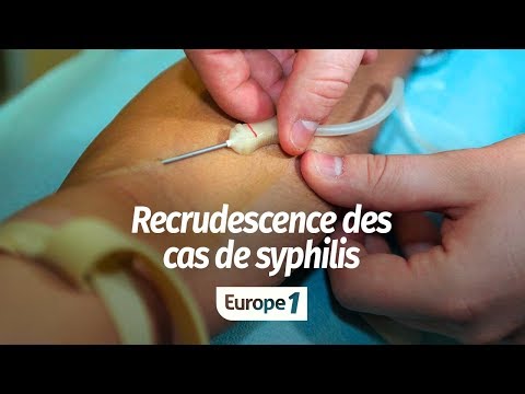 Vidéo: Comment La Syphilis Est-elle Arrivée En Europe? - Vue Alternative