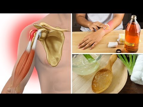 6 Home Remedies for Tendinitis That Actually Work (Tendonitis)
