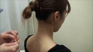 宮崎 鍼灸　肩こりの「てい鍼」治療 ― 高野鍼灸リラクセーション