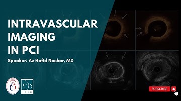 VIFO (April 19th, 2025) - Intravascular Imaging in PCI