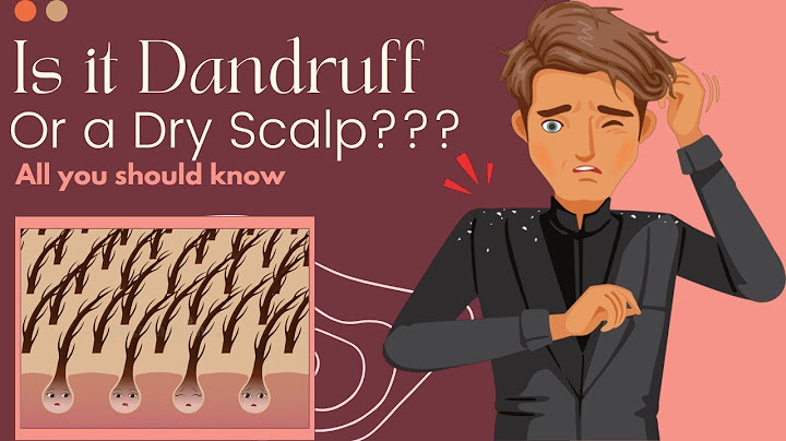 What is good to use for dry scalp