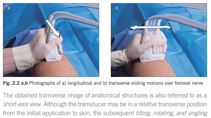Ultrasound Guidance for Vascular Access and Region...