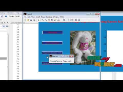 Final Year Projects | Robust Interactive Image Segmentation Using Convex Active Contours