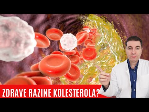 Koje su zdrave razine KOLESTEROLA u tijelu?