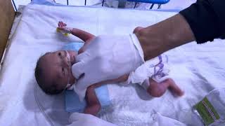 LBW Newborn Baby Critical Condition  Mild Cyanosis &amp; Grunting  Emergency NICU Care 👶