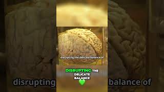 Lack of Sleep: The Silent Brain Killer Revealed