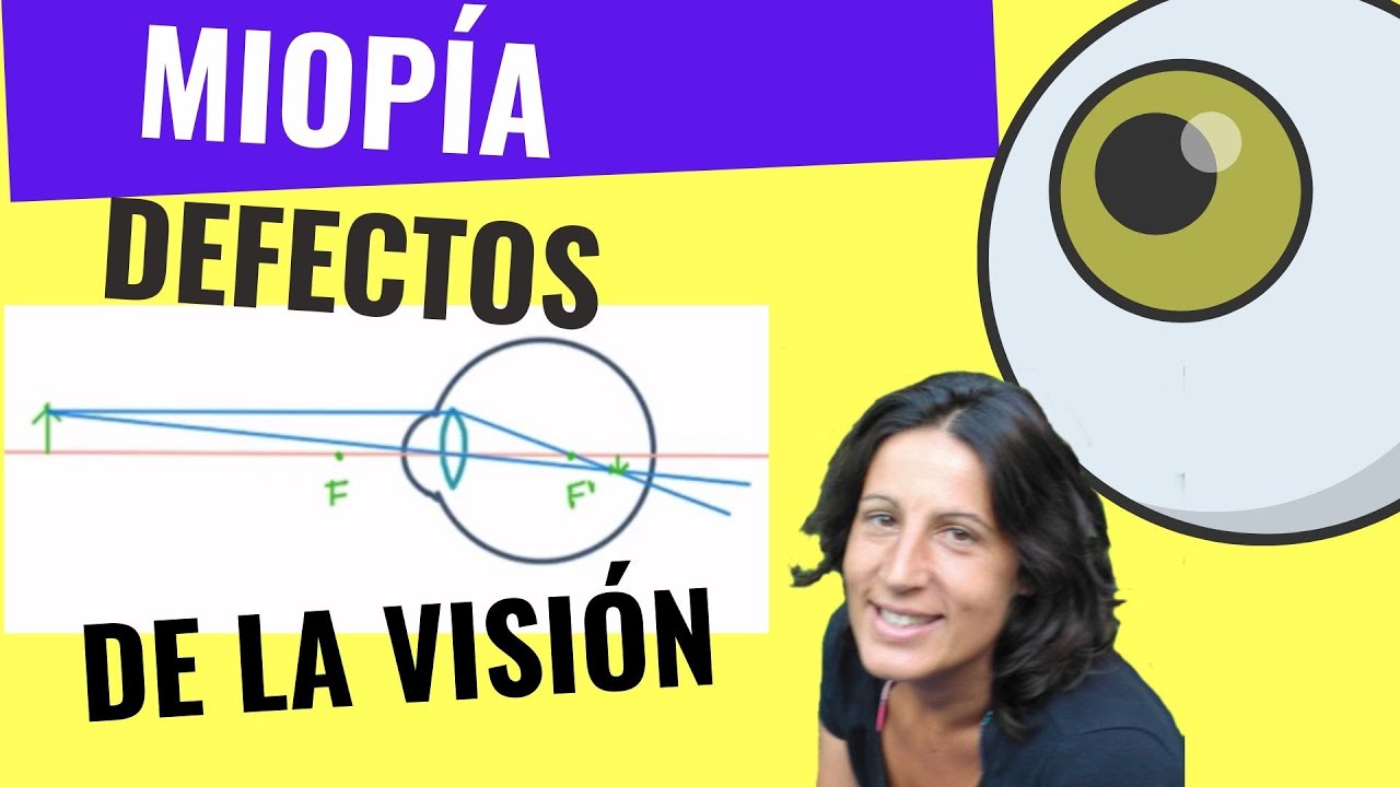 Defectos de refracción de la visión: miopía. Potencia d… — Transcript