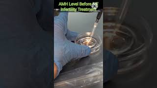 AMH Level Before IVF Infertility Treatment #ivf #pregnancy#treatment#amhlevels #icsi #infertility#yt