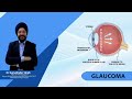 👁️ Glaucoma Awareness: Protect Your Vision with Expert Care #AdeshGroup #ApkaAdesh