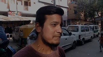 The Mummy Effect(Buggs) After Effect Videos