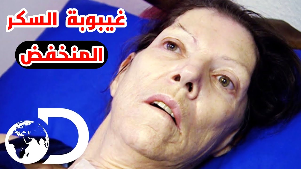تتصرف ازاي لو شخص دخل في غيبوبة سكر منخفض_Hypoglycemia: Definition, Identification and Treatment