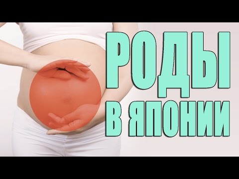 РОДЫ в Японии