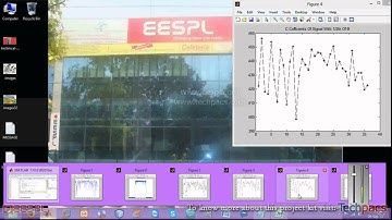 ECG Feature Extraction | ST Segment Detection | Disease Detection (latest Project 2020)