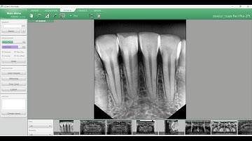 How to rotate your scans and save for future in EzDent I Vatech Software
