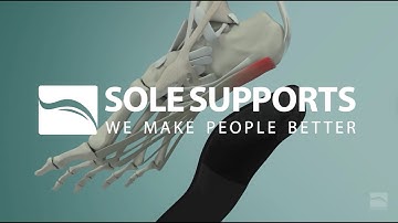Sole Supports Waiting Room Video — 2025