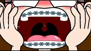 Scream Zoom Mouth Uvula