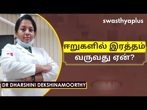 ஈறுகளில் இரத்தம் வருவது ஏன்? | Bleeding gums in Tamil | Dr Dharshini Dekshinamoorthy