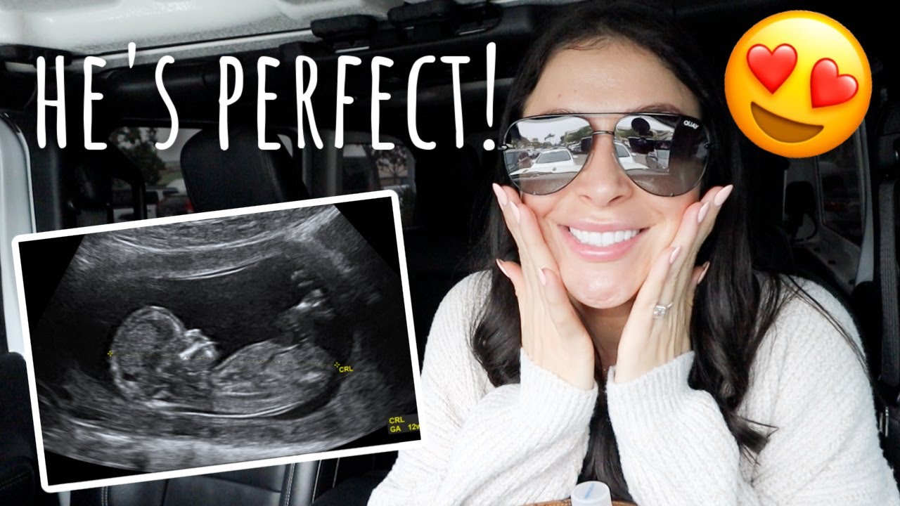 seeing baby boy for the second time! 13 week ultrasound😍 YouTube