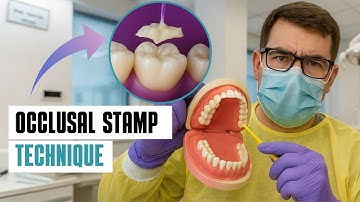 How to Easily Restore Occlusal Anatomy of a Posterior Tooth — Stamp Technique