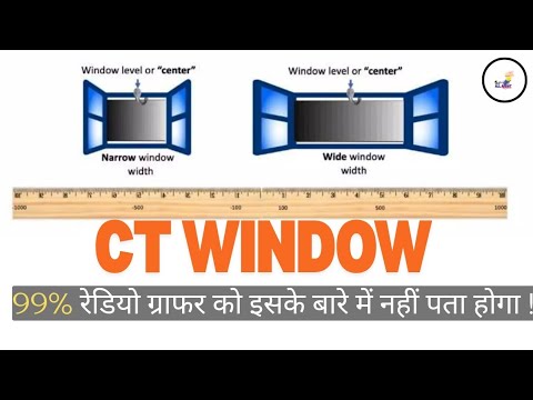 Ct windowing| Window Width (WW) | Window level| All about Radio