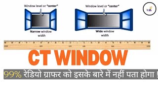 Ct windowing| Window Width (WW) | Window level| All about Radio Profile