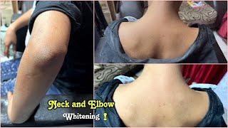 Hand & Body Tan Removing Easy Home Remedys !100% Effective! Skin Whitening at Home! #sunburn #Tan