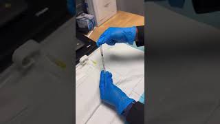 This short video shows how to prepare and inject semaglutide (2.5 mg/ml vial).
