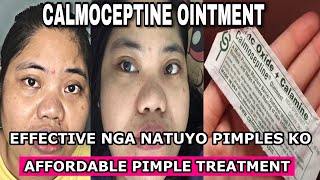 calmoseptine ointment for pimples