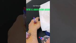 الحجامة أكادير hijama agadire centre hijama agadire مركز الحجامة أكادير 0673512415